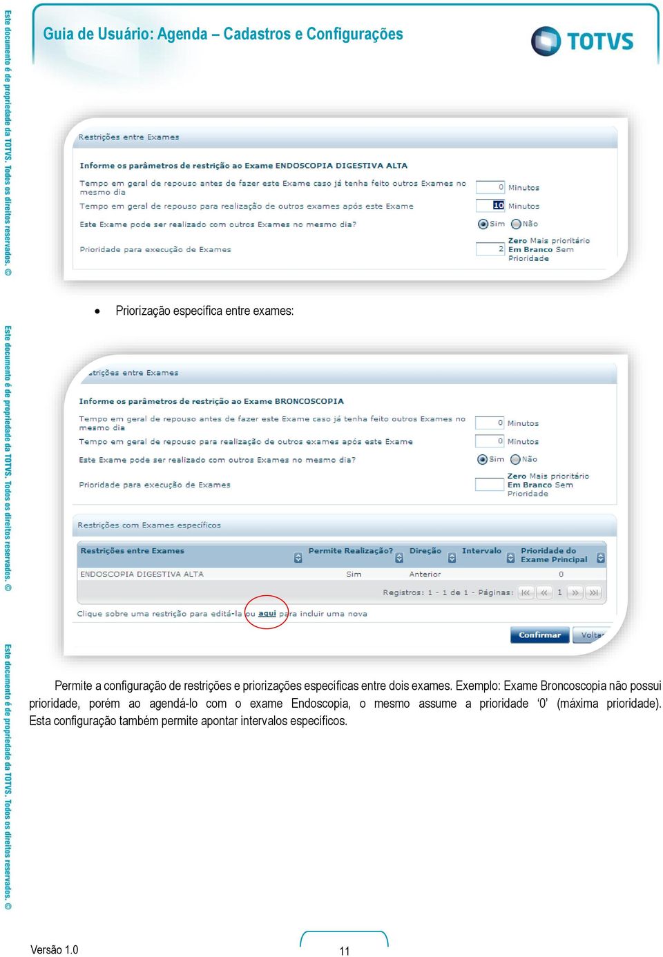 Exemplo: Exame Broncoscopia não possui prioridade, porém ao agendá-lo com o exame