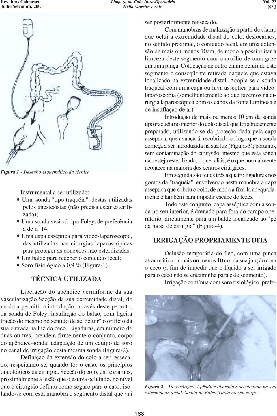 asséptica para video-laparoscopia, das utilizadas nas cirurgias laparoscópicas para proteger as conexões não esterilizadas; Um balde para receber o conteúdo fecal; Soro fisiológico a 0,9 % (Figura-1).