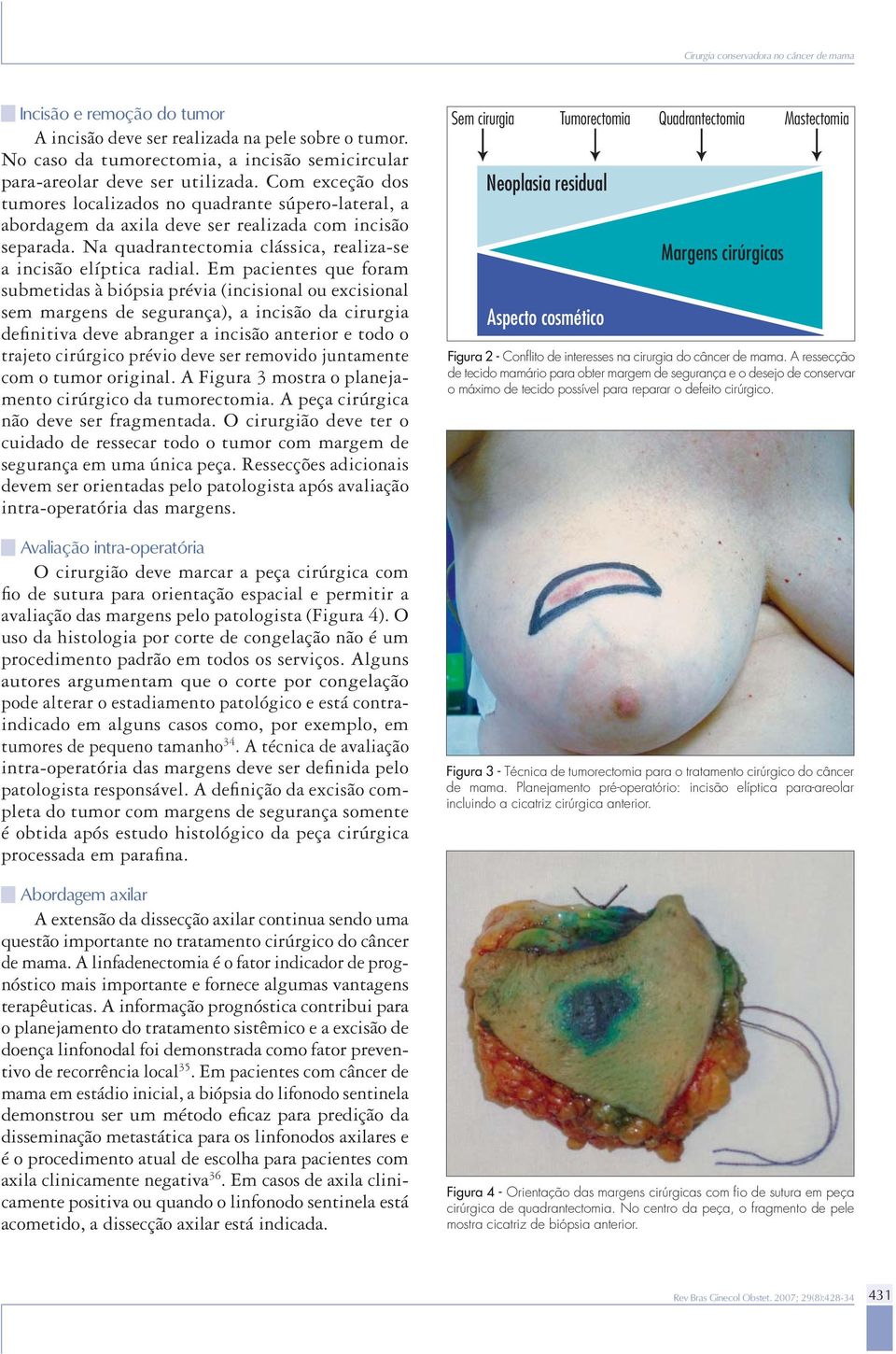 Em pacientes que foram submetidas à biópsia prévia (incisional ou excisional sem margens de segurança), a incisão da cirurgia defi nitiva deve abranger a incisão anterior e todo o trajeto cirúrgico