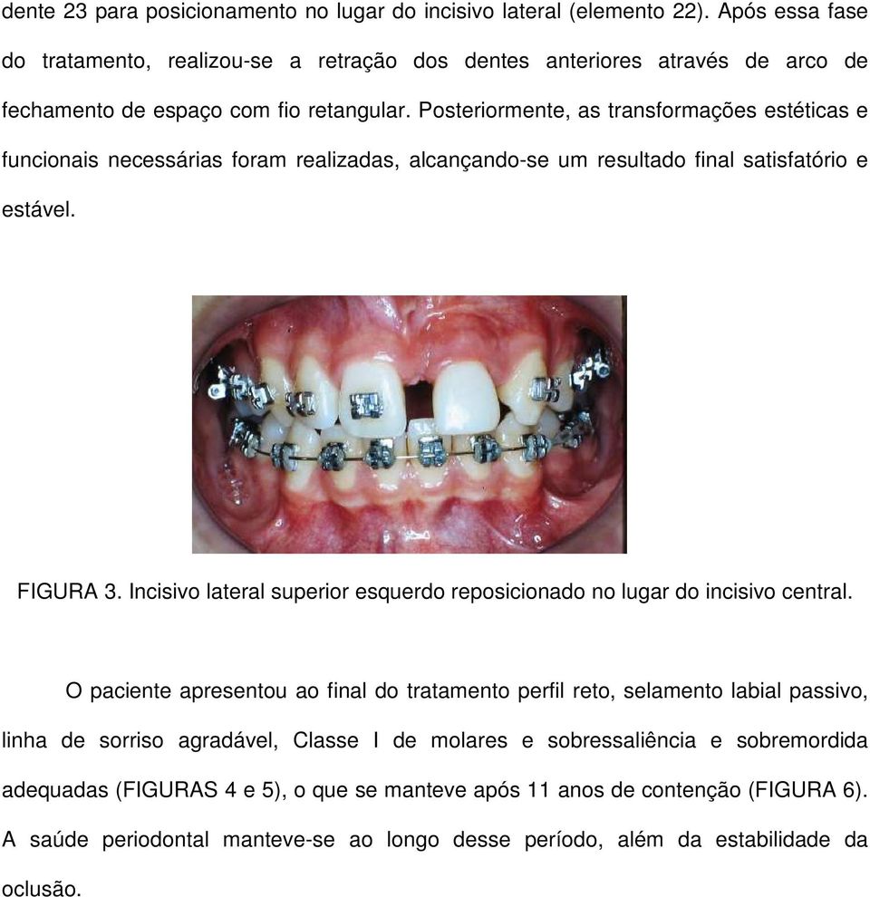 Posteriormente, as transformações estéticas e funcionais necessárias foram realizadas, alcançando-se um resultado final satisfatório e estável. FIGURA 3.