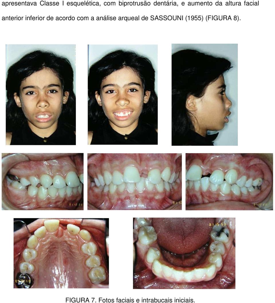 inferior de acordo com a análise arqueal de SASSOUNI