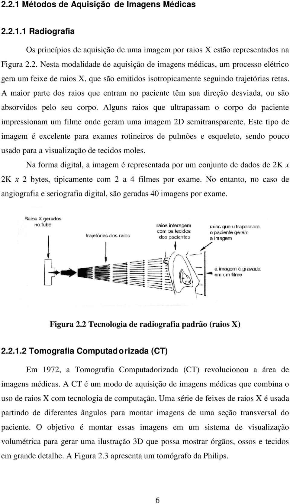 Alguns raios que ultrapassam o corpo do paciente impressionam um filme onde geram uma imagem 2D semitransparente.