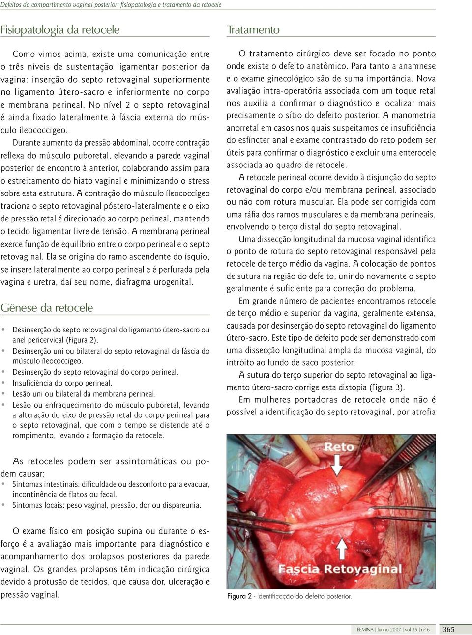 Durante aumento da pressão abdominal, ocorre contração reflexa do músculo puboretal, elevando a parede vaginal posterior de encontro à anterior, colaborando assim para o estreitamento do hiato