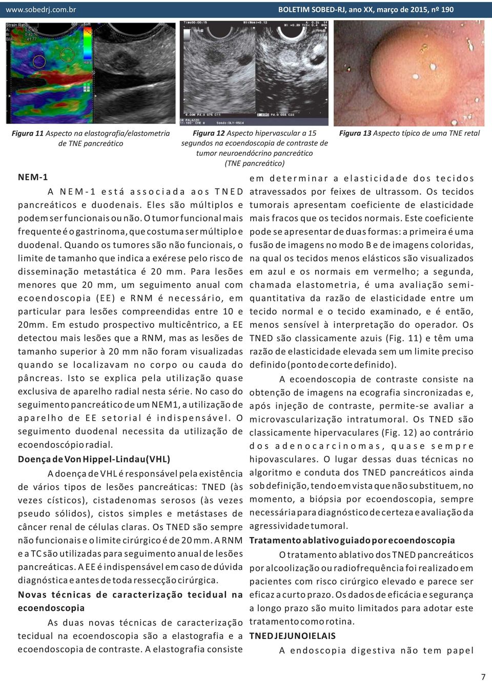 Quando os tumores são não funcionais, o limite de tamanho que indica a exérese pelo risco de disseminação metastática é 20 mm.