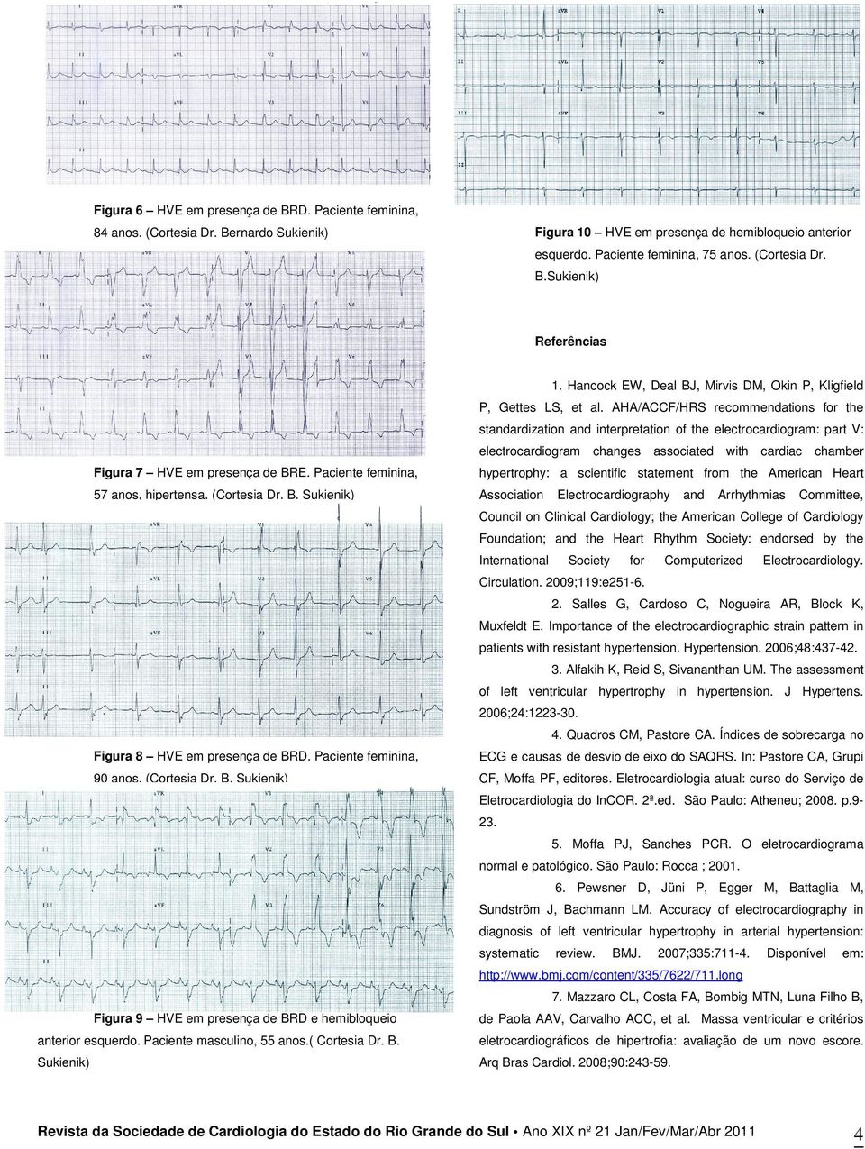 AHA/ACCF/HRS recommendations for the standardization and interpretation of the electrocardiogram: part V: electrocardiogram changes Figura 7 HVE em presença de BRE.