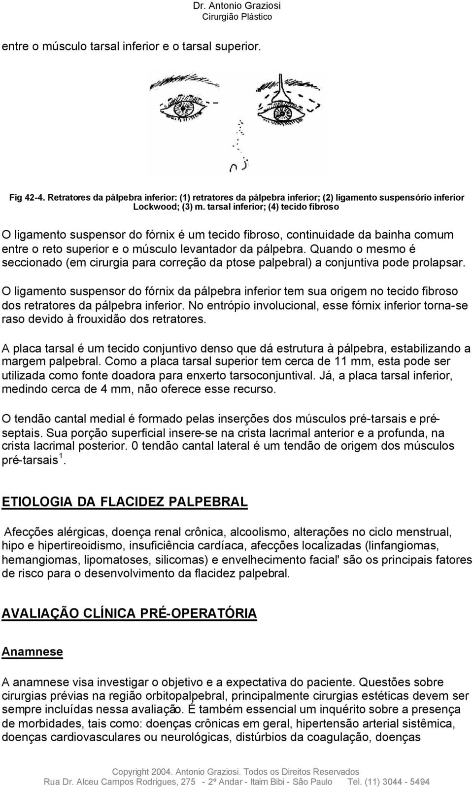 Quando o mesmo é seccionado (em cirurgia para correção da ptose palpebral) a conjuntiva pode prolapsar.