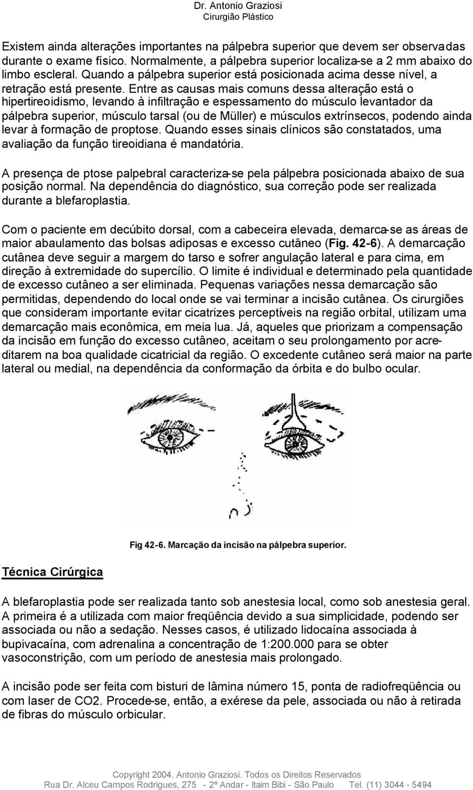 Entre as causas mais comuns dessa alteração está o hipertireoidismo, levando à infiltração e espessamento do músculo levantador da pálpebra superior, músculo tarsal (ou de Müller) e músculos