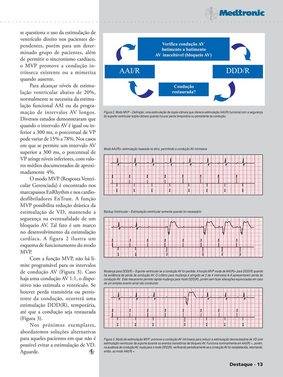 Para alcançar níveis de estimulação ventricular abaixo de 20%, normalmente se necessita da estimulação funcional AAI ou da programação de intervalos AV longos.