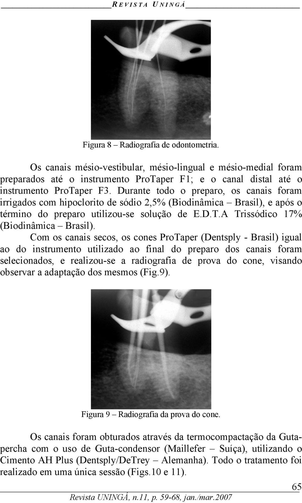 Com os canais secos, os cones ProTaper (Dentsply - Brasil) igual ao do instrumento utilizado ao final do preparo dos canais foram selecionados, e realizou-se a radiografia de prova do cone, visando
