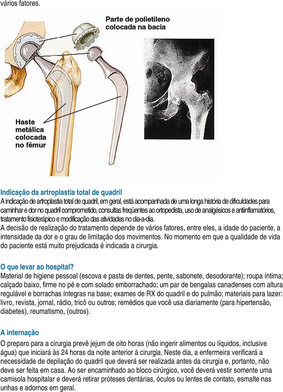 consultas freqüentes ao ortopedista, uso de analgésicos e antiinflamatórios, tratamento fisioterápico e modificação das atividades no dia-a-dia.