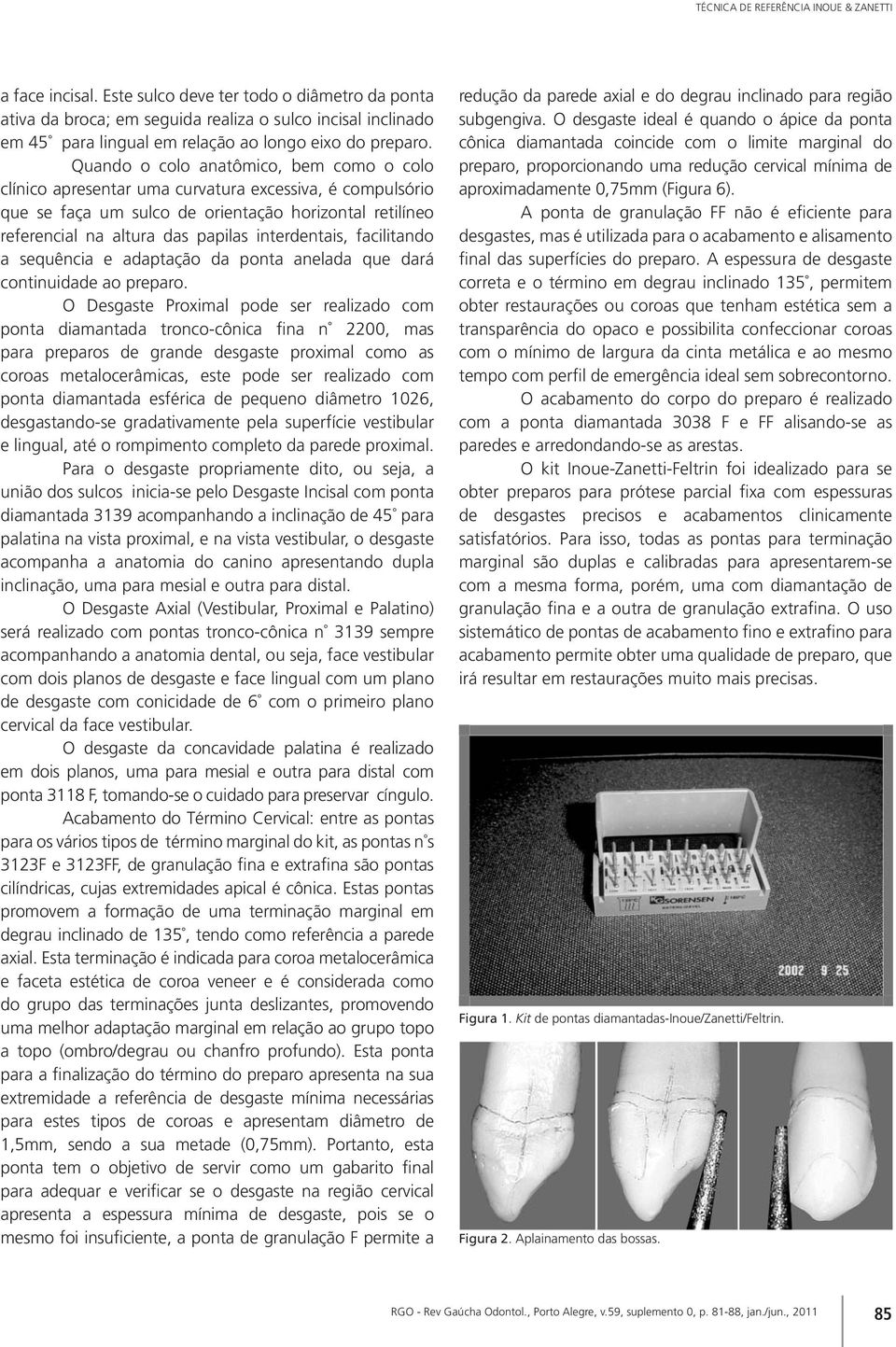 Quando o colo anatômico, bem como o colo clínico apresentar uma curvatura excessiva, é compulsório que se faça um sulco de orientação horizontal retilíneo referencial na altura das papilas