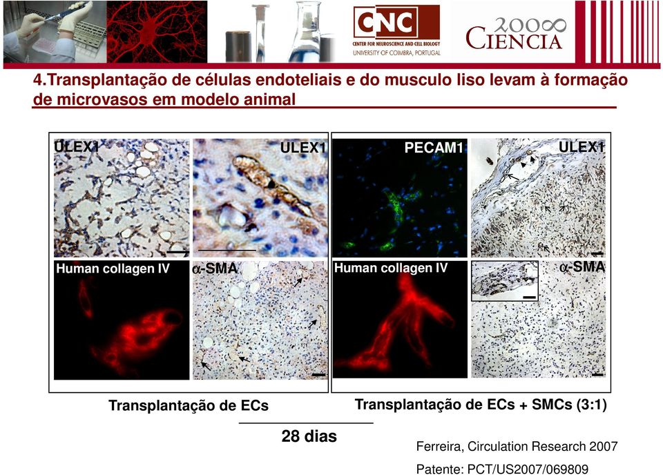 Human collagen IV ULEX1 α-sma Transplantação de ECs + SMCs (3:1)