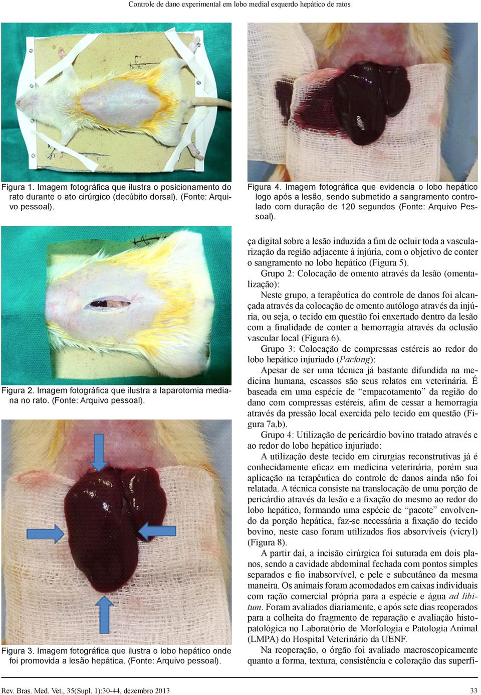 Imagem fotográfica que ilustra o lobo hepático onde foi promovida a lesão hepática. (Fonte: Arquivo pessoal). Figura 4.