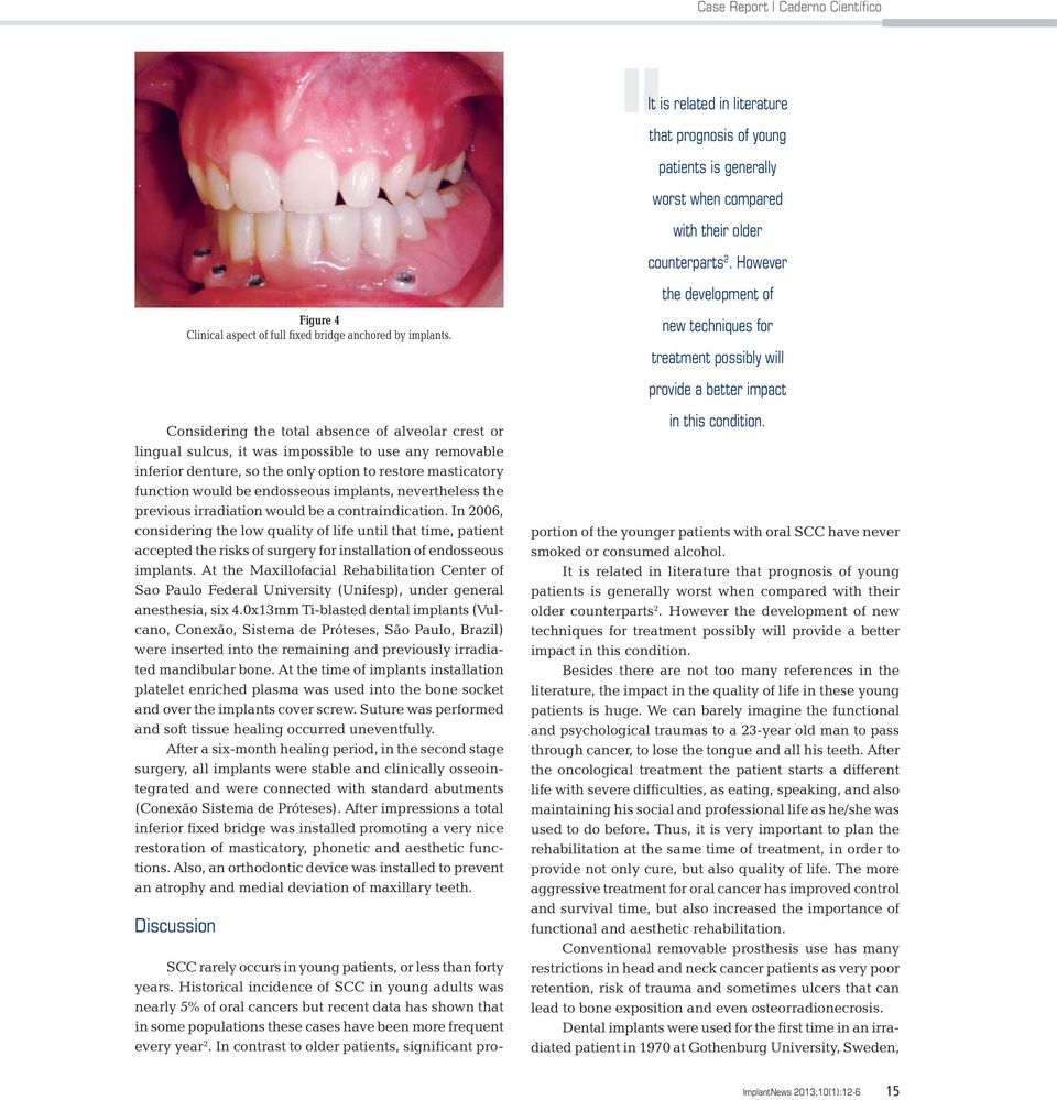 In 2006, considering the low quality of life until that time, patient accepted the risks of surgery for installation of endosseous implants.