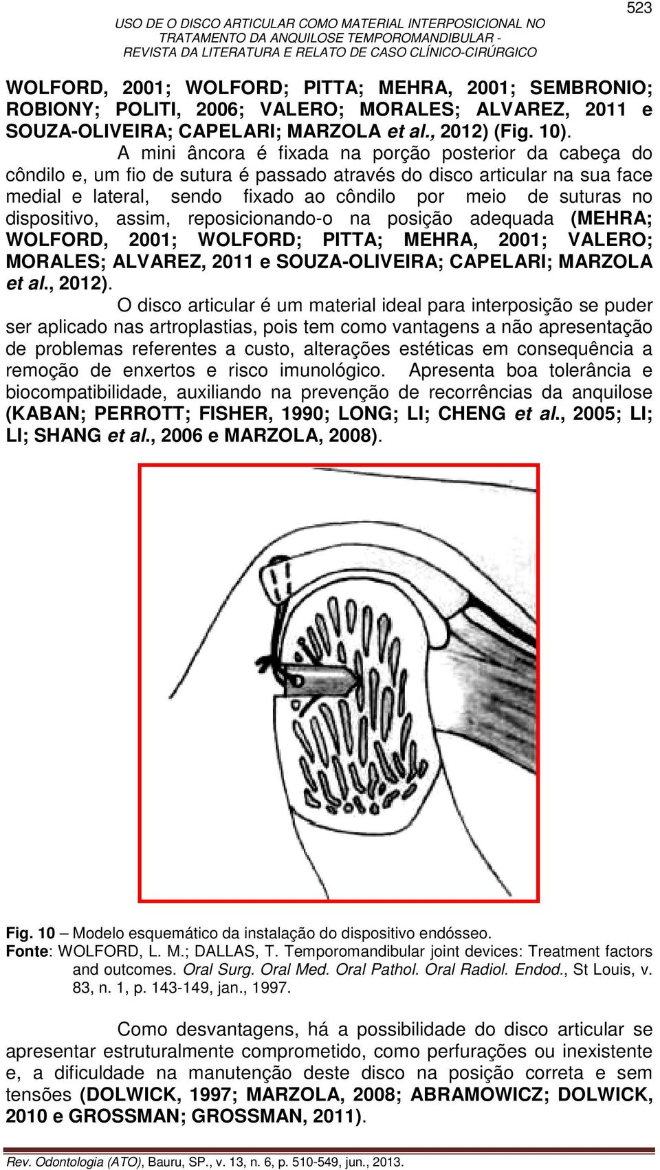 dispositivo, assim, reposicionando-o na posição adequada (MEHRA; WOLFORD, 2001; WOLFORD; PITTA; MEHRA, 2001; VALERO; MORALES; ALVAREZ, 2011 e SOUZA-OLIVEIRA; CAPELARI; MARZOLA et al., 2012).