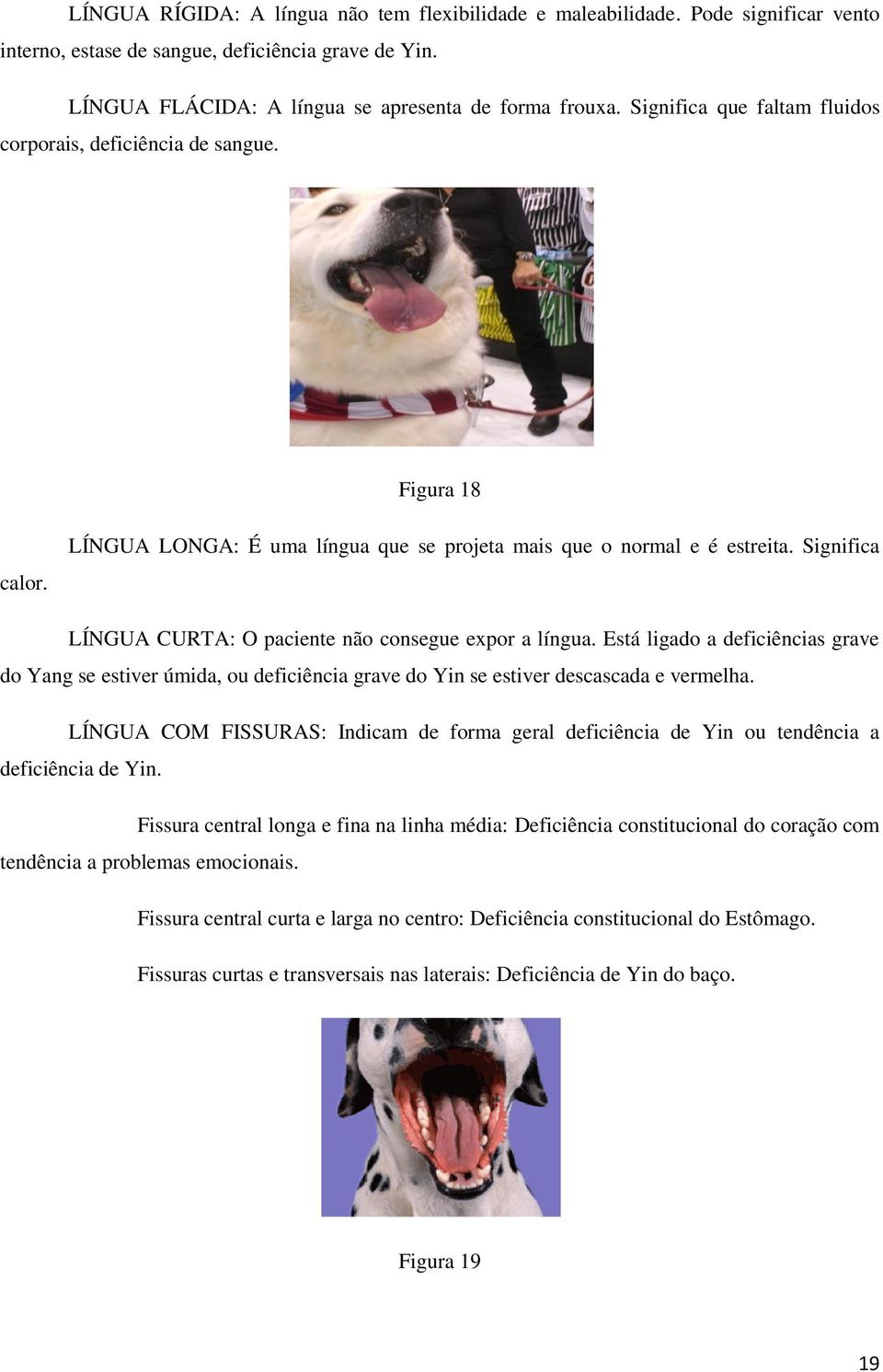 Significa LÍNGUA CURTA: O paciente não consegue expor a língua. Está ligado a deficiências grave do Yang se estiver úmida, ou deficiência grave do Yin se estiver descascada e vermelha.