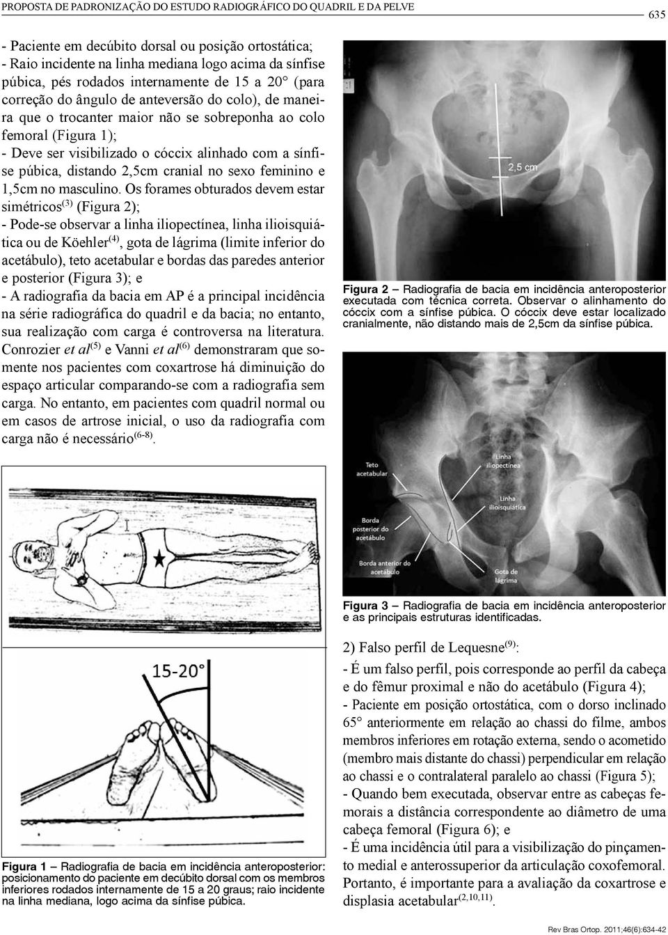 alinhado com a sínfise púbica, distando 2,5cm cranial no sexo feminino e 1,5cm no masculino.