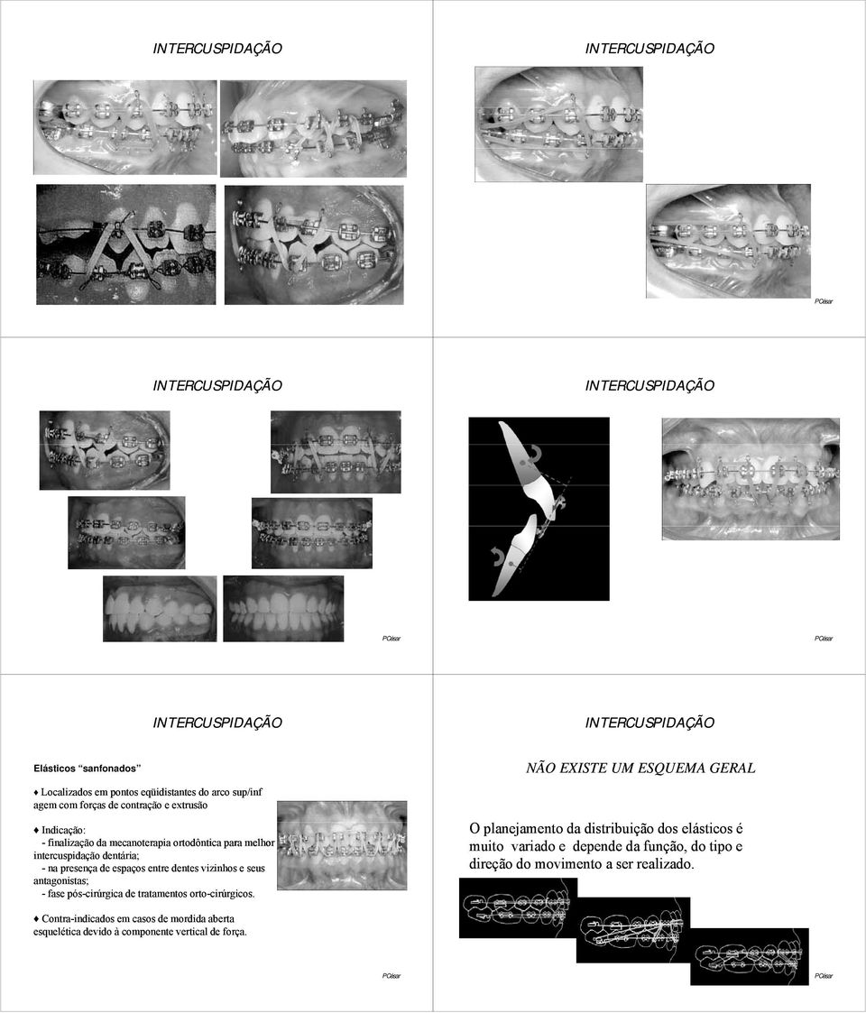 pós-cirúrgica de tratamentos orto-cirúrgicos.