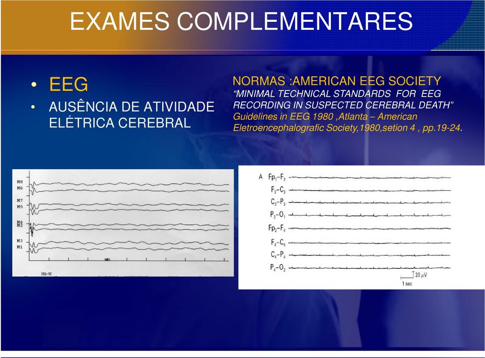 RECORDING IN SUSPECTED CEREBRAL DEATH Guidelines in EEG