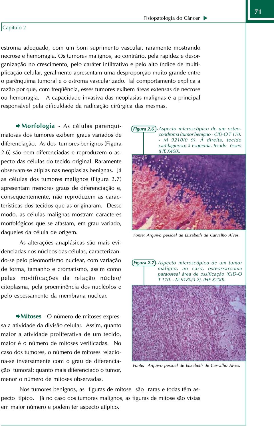 grande entre o parênquima tumoral e o estroma vascularizado. Tal comportamento explica a razão por que, com freqüência, esses tumores exibem áreas extensas de necrose ou hemorragia.