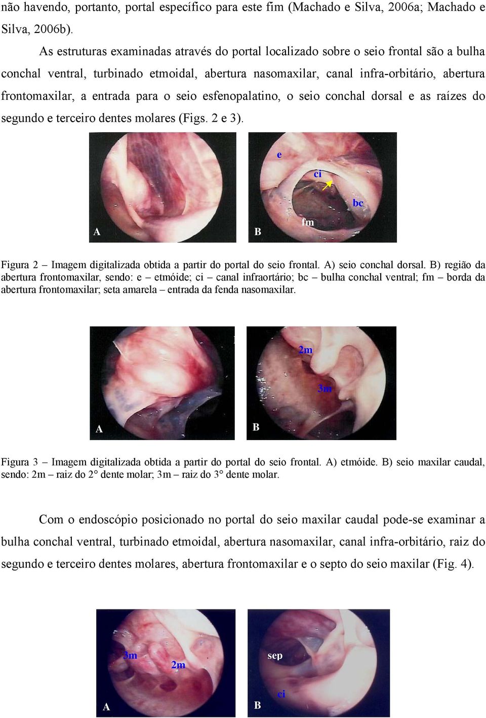 entrada para o seio esfenopalatino, o seio conchal dorsal e as raízes do segundo e terceiro dentes molares (Figs. 2 e 3).