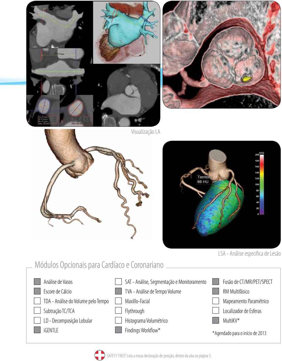 Segmentação e Monitoramento TVA - Análise de Tempo Volume Maxillo-Facial Flythrough Histograma Volumétrico Findings