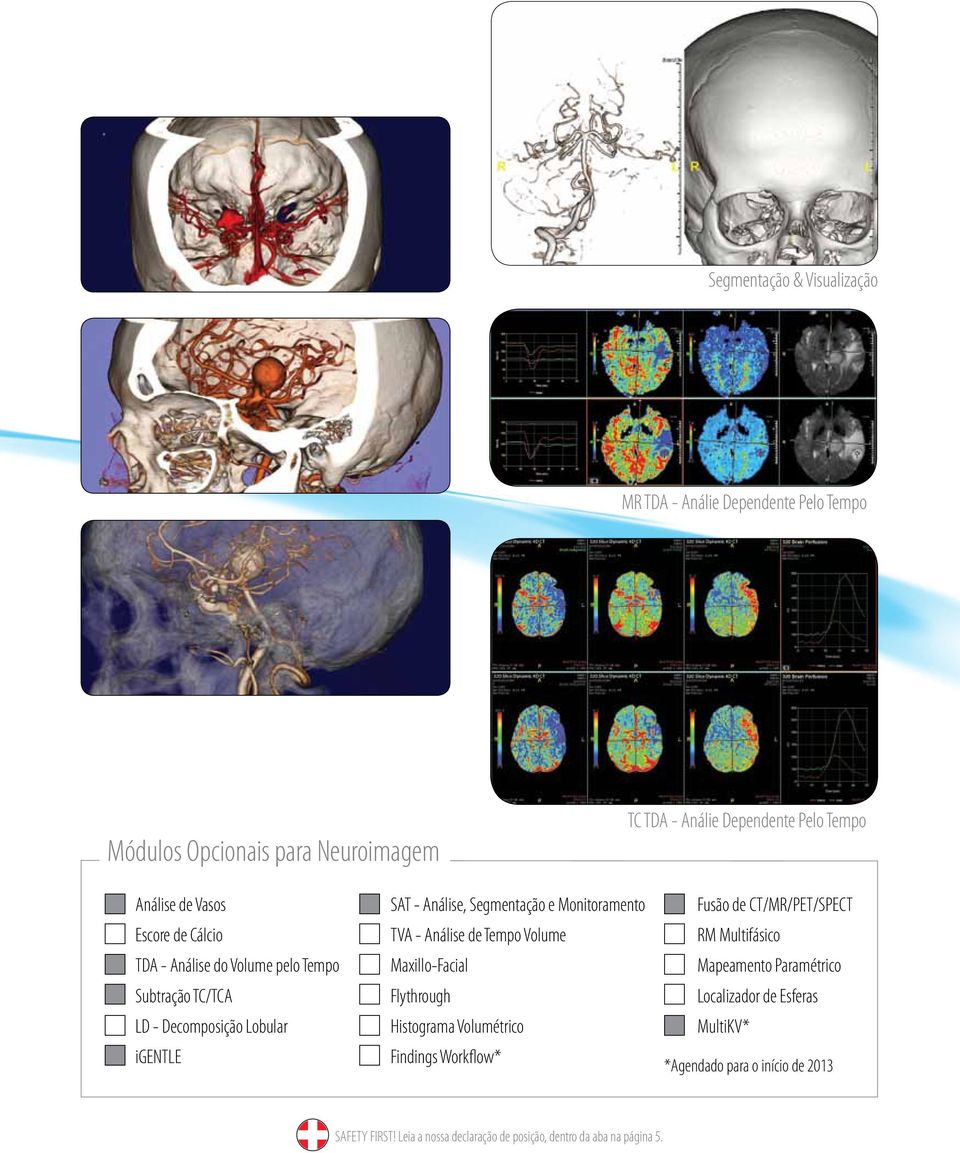 Análise, Segmentação e Monitoramento TVA - Análise de Tempo Volume Maxillo-Facial Flythrough Histograma Volumétrico Findings