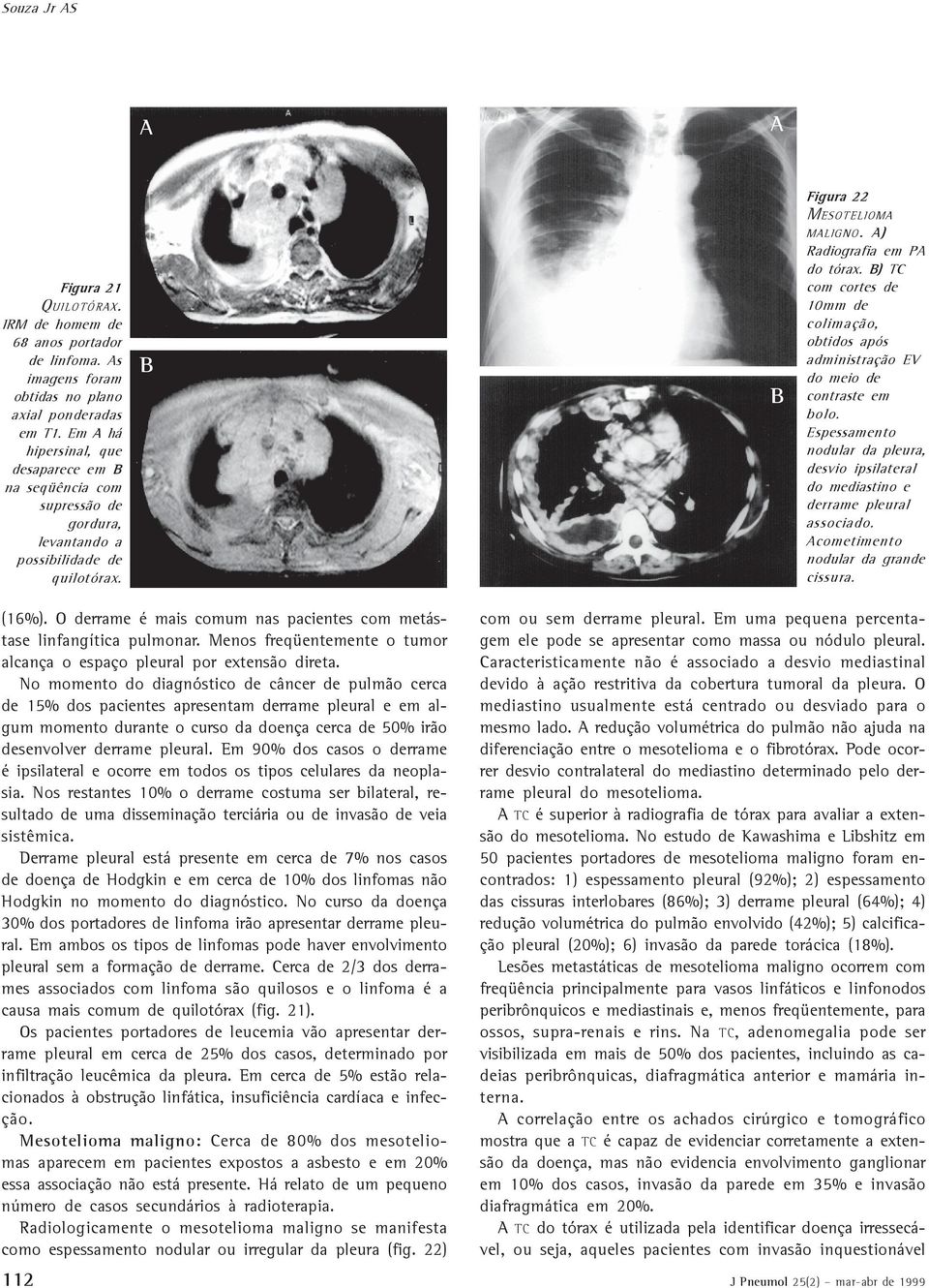 s imagens foram obtidas no plano axial ponderadas em T1. Em há hipersinal, que desaparece em na seqüência com supressão de gordura, levantando a possibilidade de quilotórax. (16%).