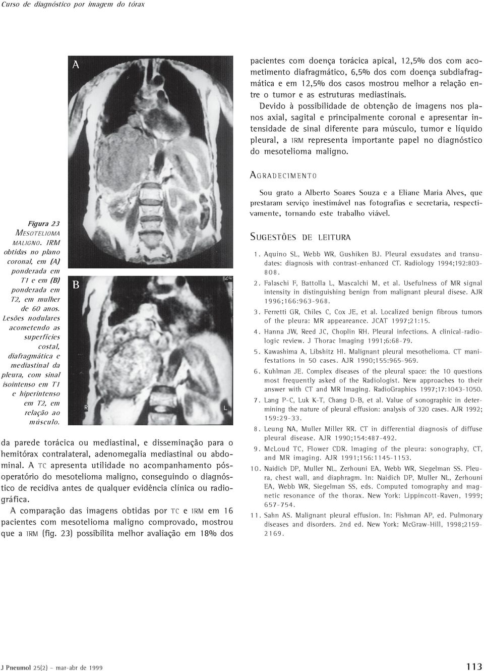 Devido à possibilidade de obtenção de imagens nos planos axial, sagital e principalmente coronal e apresentar intensidade de sinal diferente para músculo, tumor e líquido pleural, a IRM representa