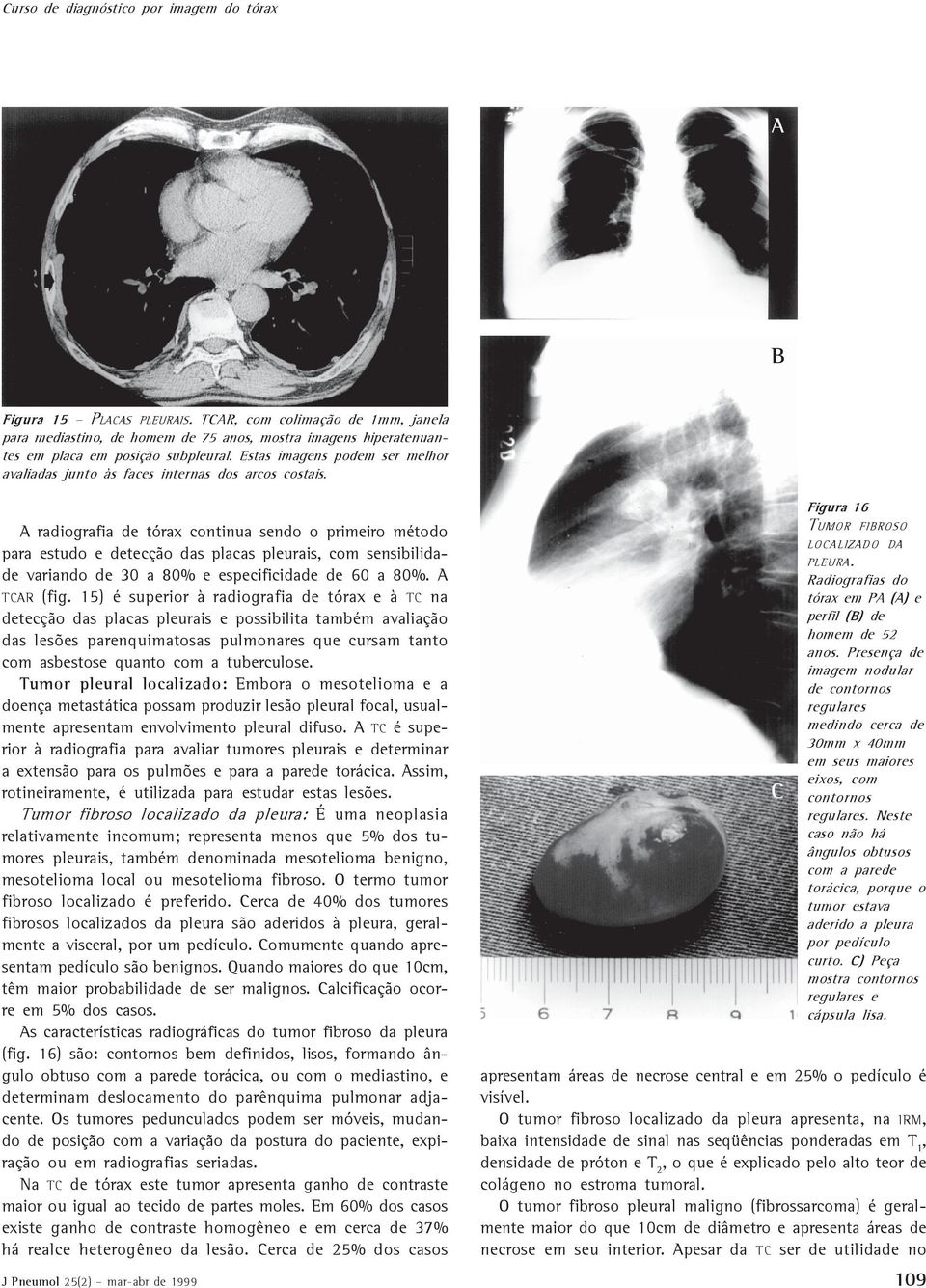 radiografia de tórax continua sendo o primeiro método para estudo e detecção das placas pleurais, com sensibilidade variando de 30 a 80% e especificidade de 60 a 80%. TCR (fig.