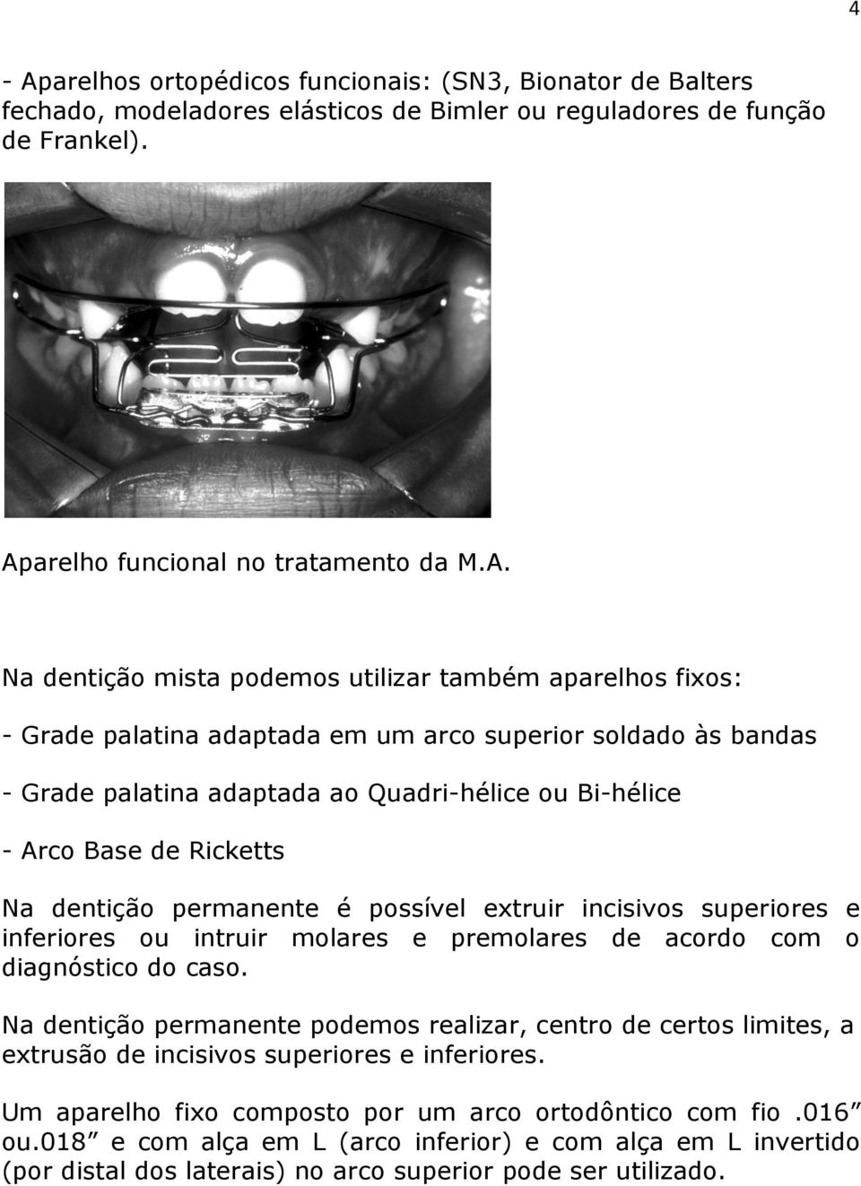 arelho funcional no tratamento da M.A.