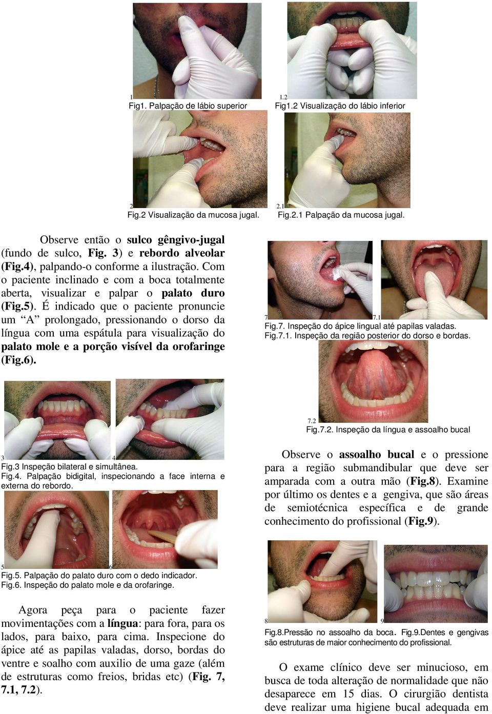 Com o paciente inclinado e com a boca totalmente aberta, visualizar e palpar o palato duro (Fig.5).