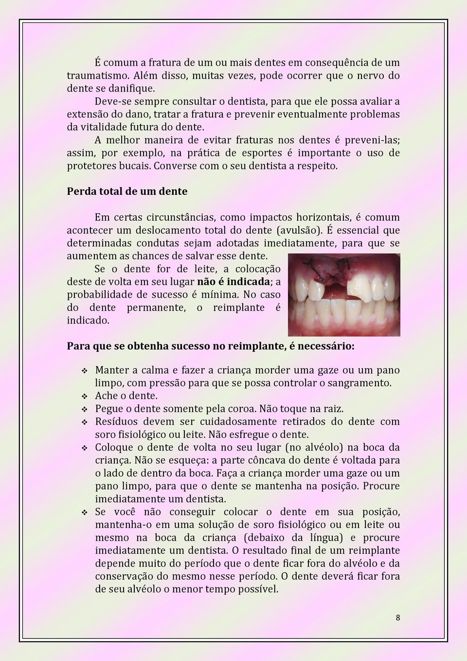 A melhor maneira de evitar fraturas nos dentes é preveni-las; assim, por exemplo, na prática de esportes é importante o uso de protetores bucais. Converse com o seu dentista a respeito.