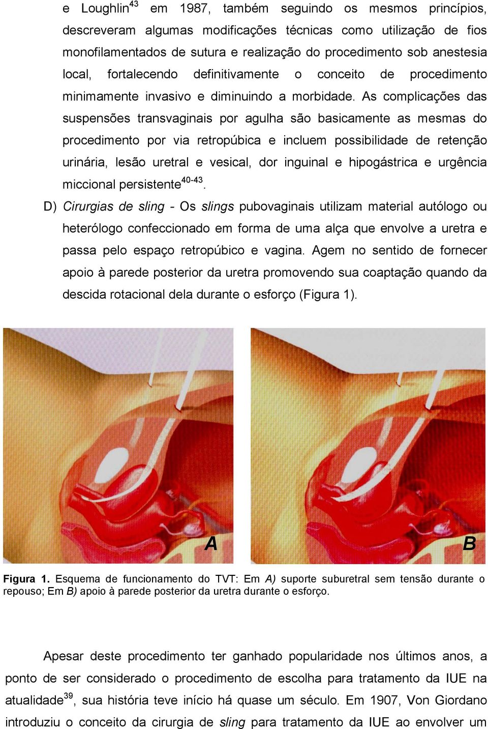 As complicações das suspensões transvaginais por agulha são basicamente as mesmas do procedimento por via retropúbica e incluem possibilidade de retenção urinária, lesão uretral e vesical, dor