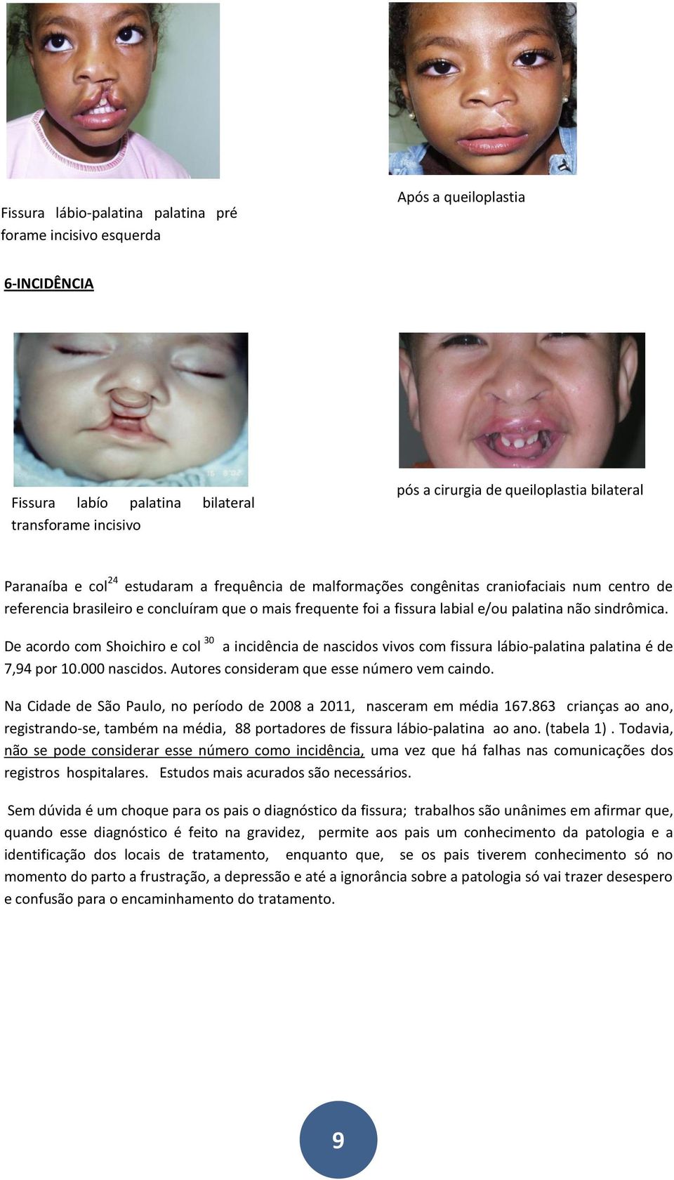 fissura labial e/ou palatina não sindrômica. De acordo com Shoichiro e col 30 a incidência de nascidos vivos com fissura lábio-palatina palatina é de 7,94 por 10.000 nascidos.