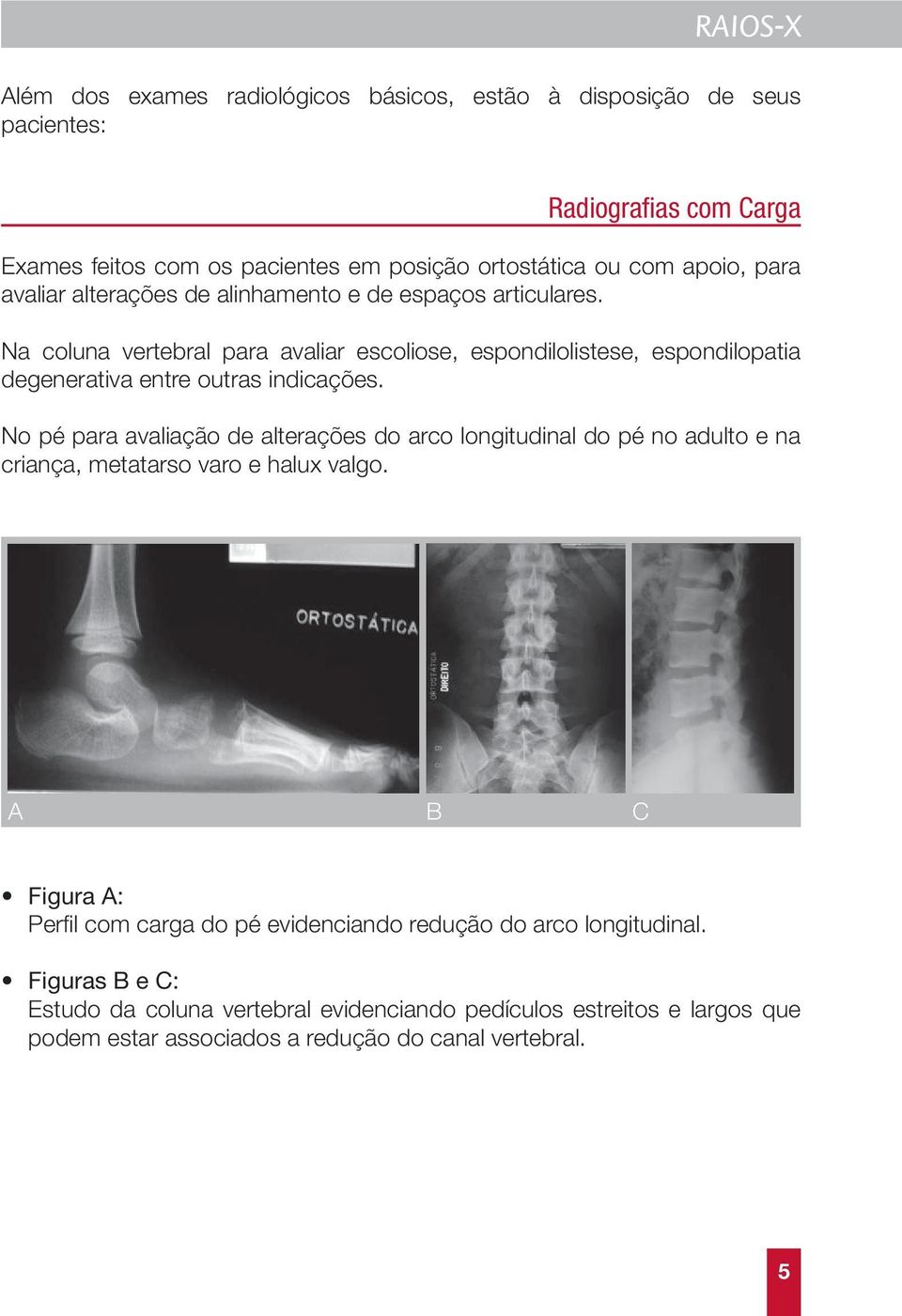 Na coluna vertebral para avaliar escoliose, espondilolistese, espondilopatia degenerativa entre outras indicações.