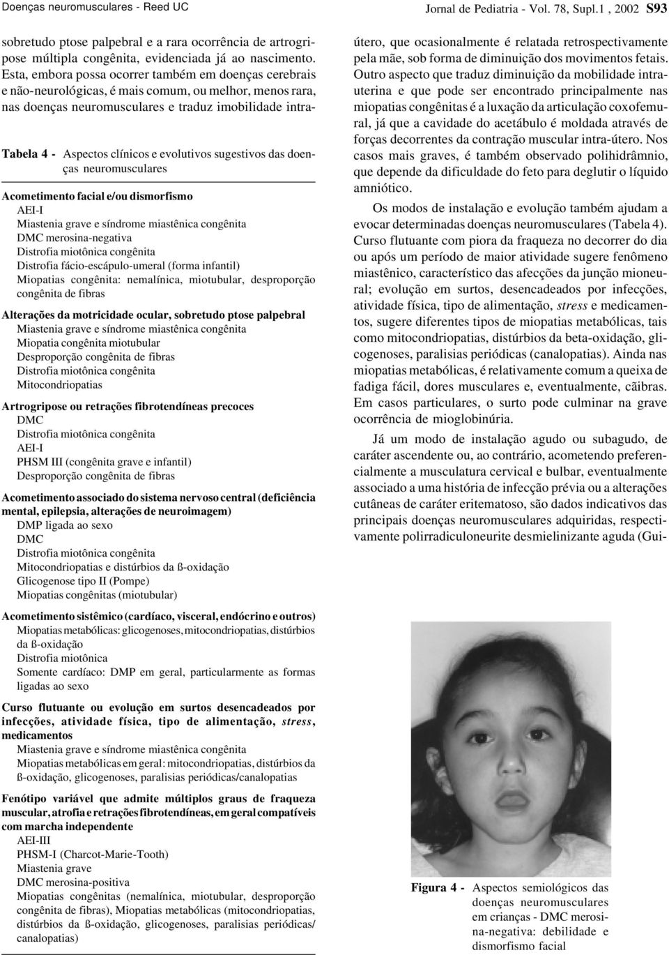 evolutivos sugestivos das doenças neuromusculares Acometimento facial e/ou dismorfismo AEI-I Miastenia grave e síndrome miastênica congênita DMC merosina-negativa Distrofia miotônica congênita