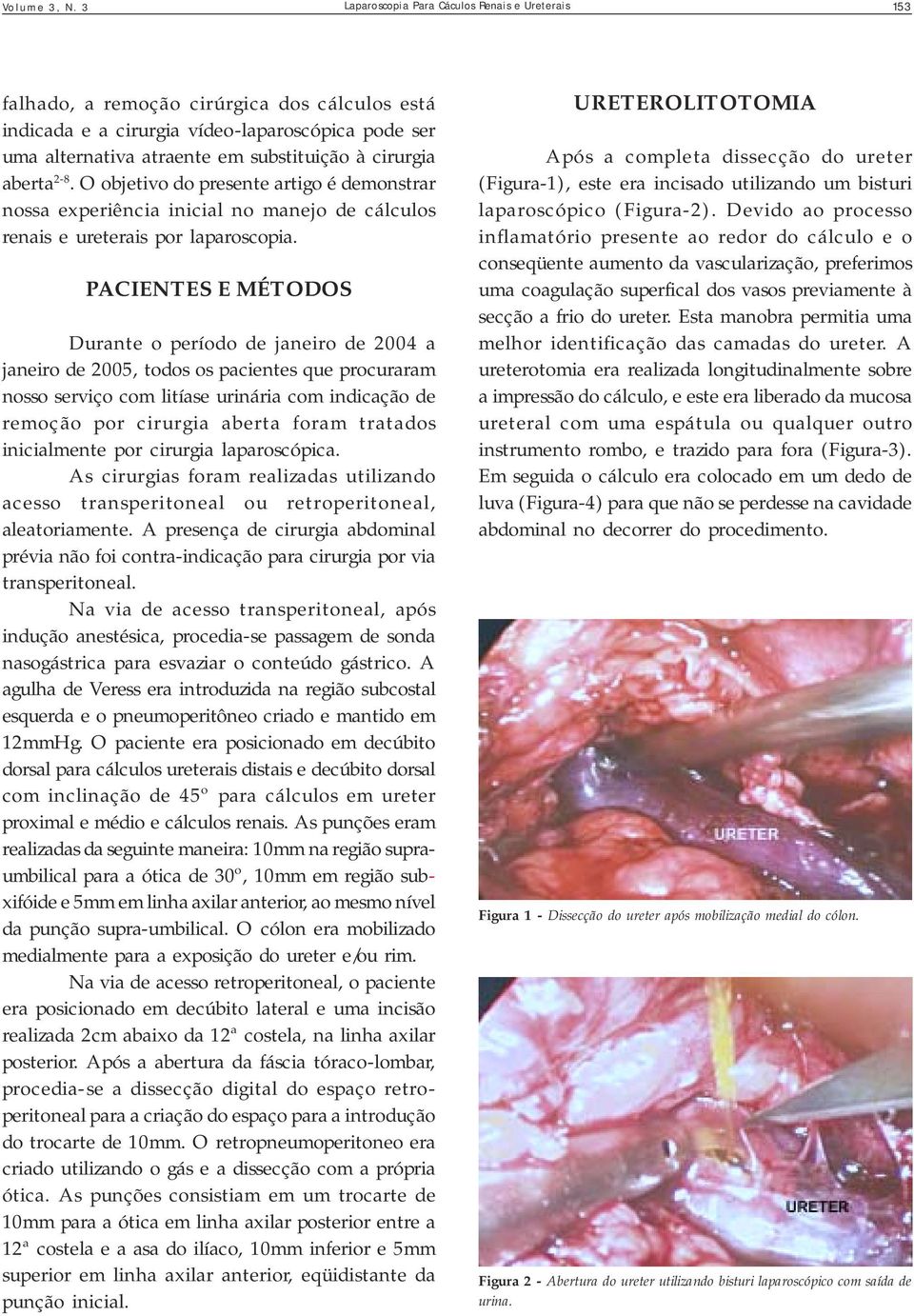 cirurgia aberta 2-8. O objetivo do presente artigo é demonstrar nossa experiência inicial no manejo de cálculos renais e ureterais por laparoscopia.