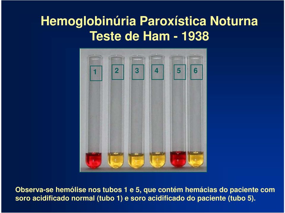 que contém hemácias do paciente com soro acidificado