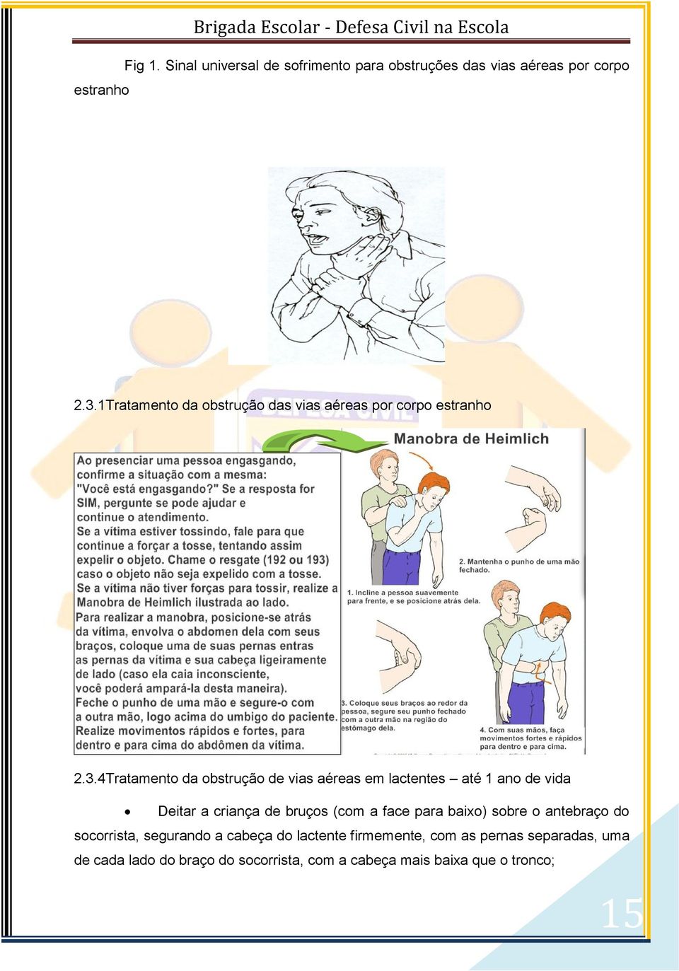 1Tratamento da obstrução das vias aéreas por corpo estranho 2.3.