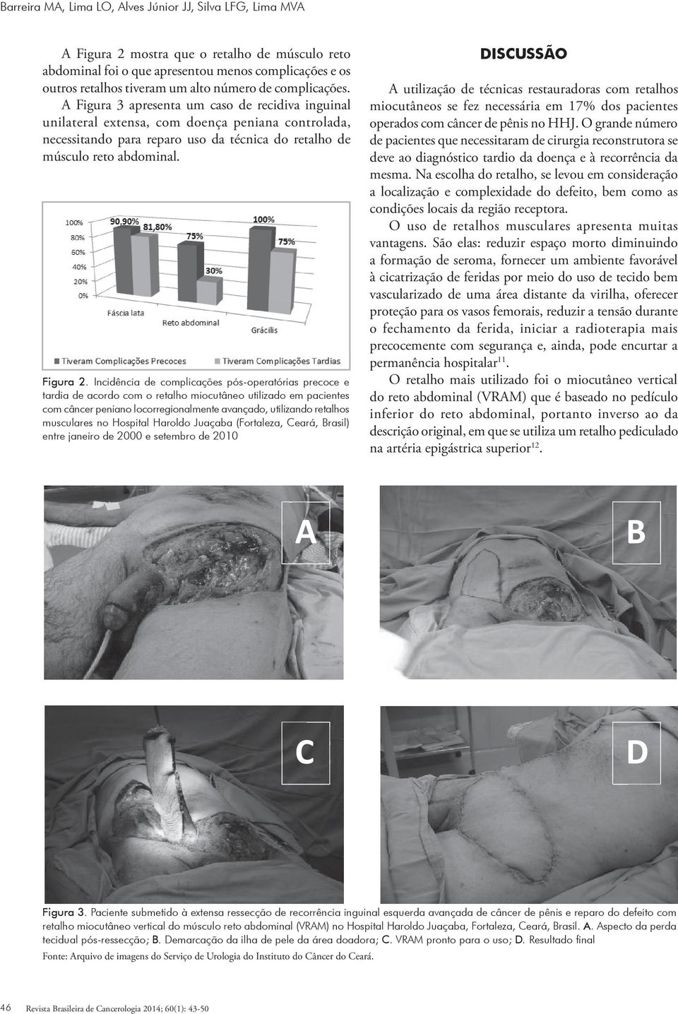 A Figura 3 apresenta um caso de recidiva inguinal unilateral extensa, com doença peniana controlada, necessitando para reparo uso da técnica do retalho de músculo reto abdominal. Figura 2.