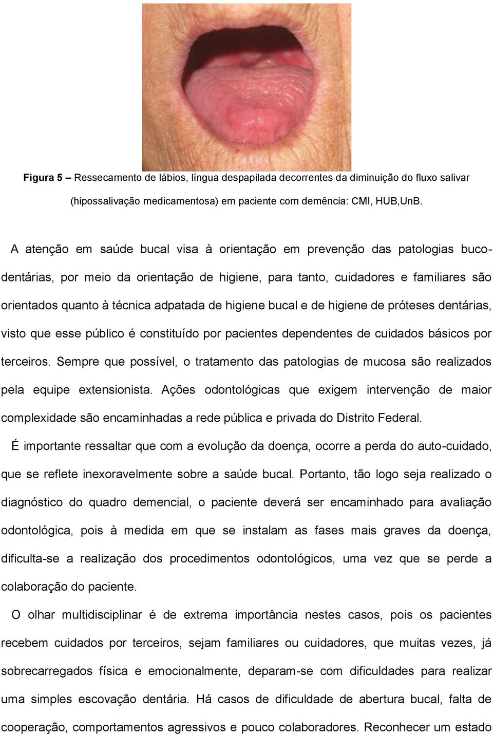 de higiene bucal e de higiene de próteses dentárias, visto que esse público é constituído por pacientes dependentes de cuidados básicos por terceiros.