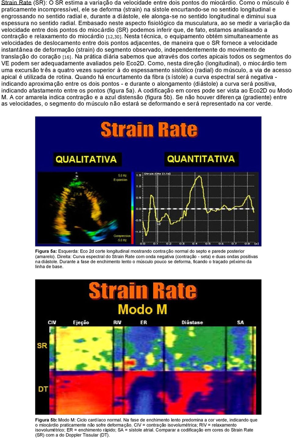 longitudinal e diminui sua espessura no sentido radial.