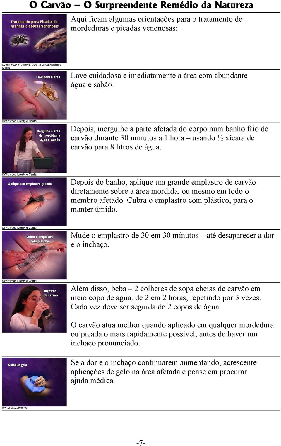 Depois do banho, aplique um grande emplastro de carvão diretamente sobre a área mordida, ou mesmo em todo o membro afetado. Cubra o emplastro com plástico, para o manter úmido.