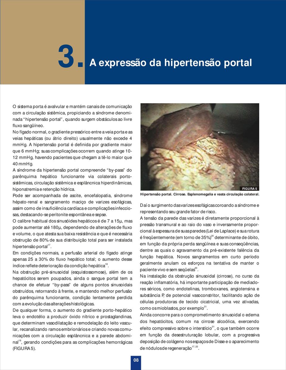 A hipertensão portal é definida por gradiente maior que 6 mmhg; suas complicações ocorrem quando atinge 10-12 mmhg, havendo pacientes que chegam a tê-lo maior que 40 mmhg.