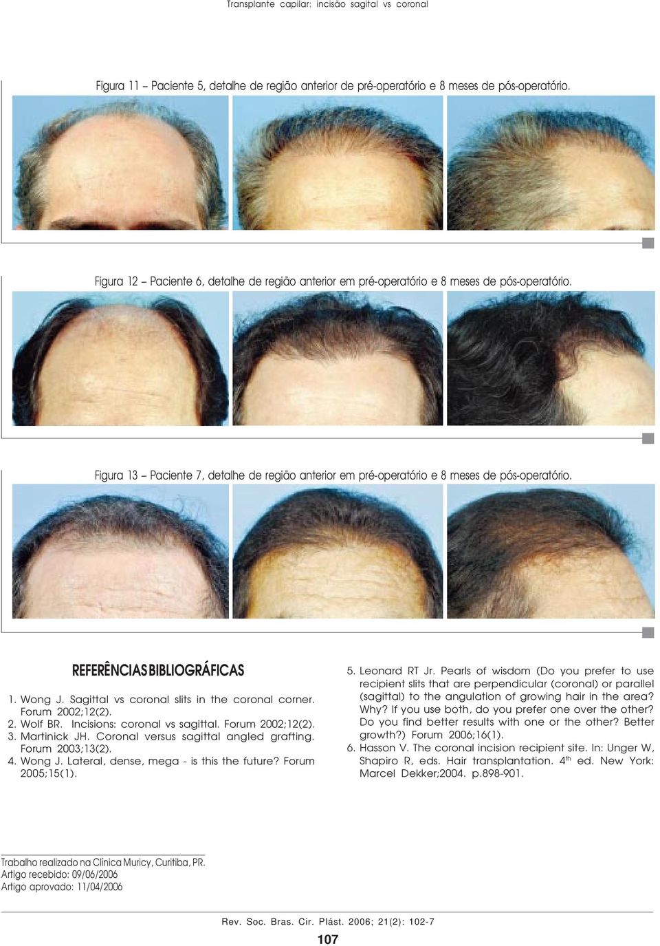 REFERÊNCIAS BIBLIOGRÁFICAS 1. Wong J. Sagittal vs coronal slits in the coronal corner. Forum 2002;12(2). 2. Wolf BR. Incisions: coronal vs sagittal. Forum 2002;12(2). 3. Martinick JH.