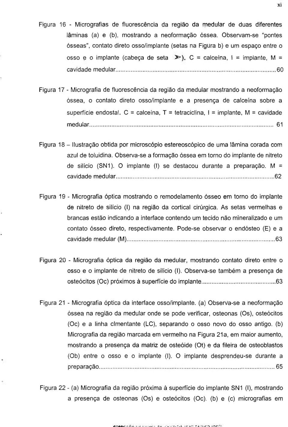 Micrografia de fluorescência da região da medular mostrando a neoformação óssea, o contato direto osso/implante e a presença de calceína sobre a superfície endostal.