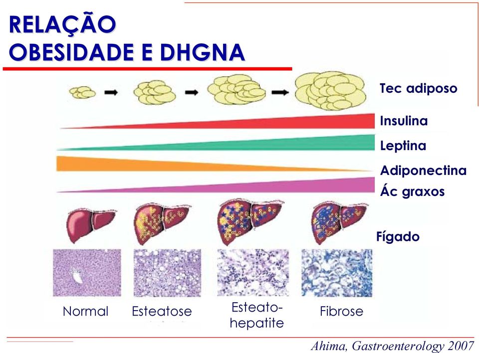 graxos Fígado Normal Esteatose