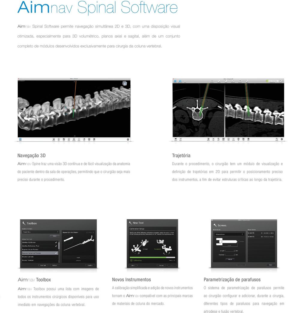 Navegação 3D Trajetória Aimnav Spine traz uma visão 3D contínua e de fácil visualização da anatomia Durante o procedimento, o cirurgião tem um módulo de visualização e do paciente dentro da sala de