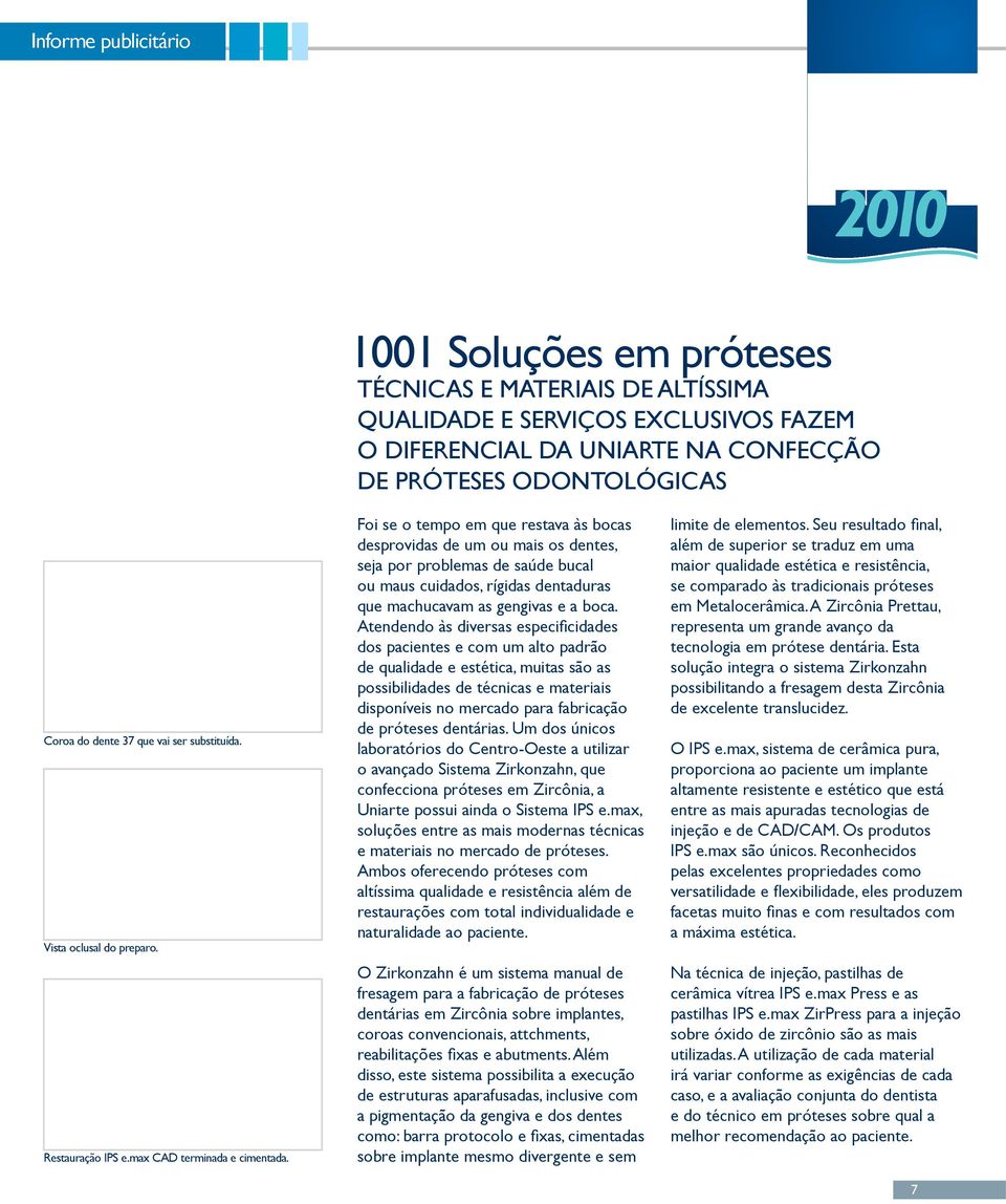 Foi se o tempo em que restava às bocas desprovidas de um ou mais os dentes, seja por problemas de saúde bucal ou maus cuidados, rígidas dentaduras que machucavam as gengivas e a boca.